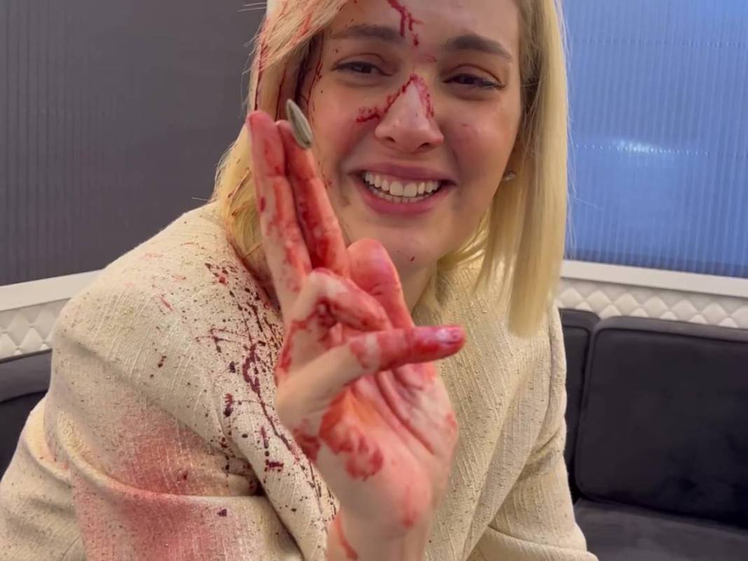 Bergüzar Korel'in kanlı paylaşımı takipçilerini korkuttu! Neden paylaştığı daha sonra ortaya çıktı 13